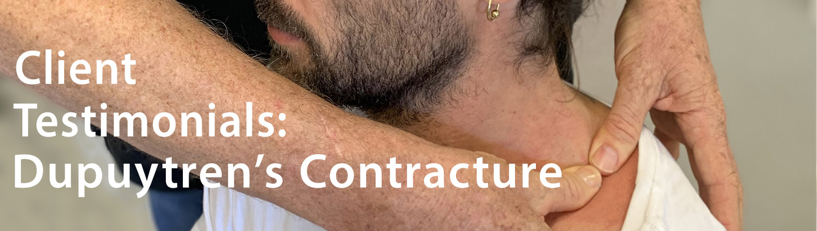 CLIENT TESTIMONIALS: DUPUTREN'S CONTRACTURE